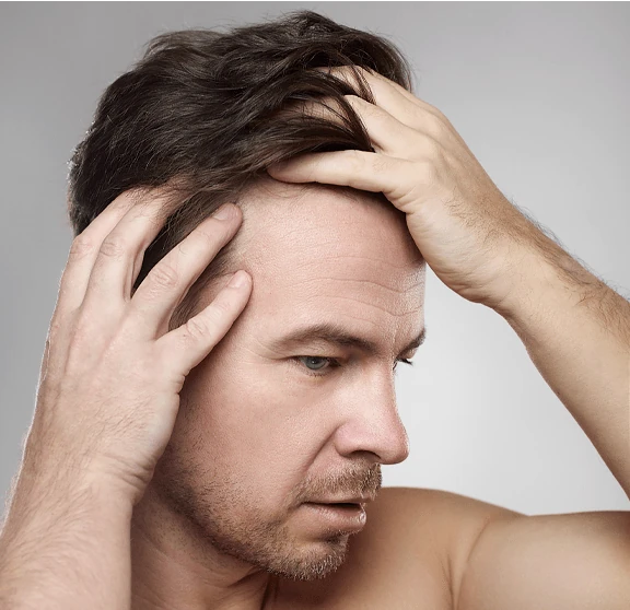 Homme avec des cheveux sains, représentant l'effet de Folicerin